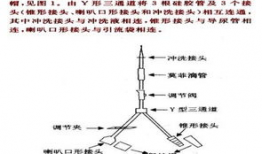 膀胱冲洗操作视频,步骤与技巧全解析